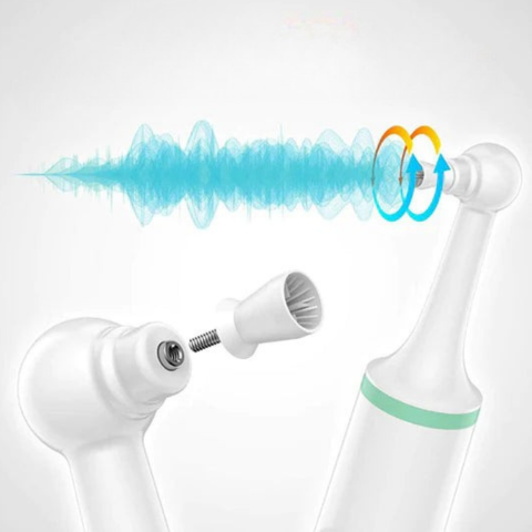 Electric Tooth Descaler - Suuhygienia & Säteilevä Hymyily